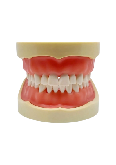 Tipodonto adulto 32